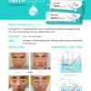 lumieyes - Filler Direct Wholesale FILLER