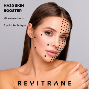1-300x300 - Filler Direct Wholesale Revitrane HA20 Skin Booster 3x 2ml