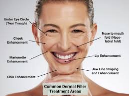 images (2) - Filler Direct Wholesale How to Choose the Right Dermal Filler?