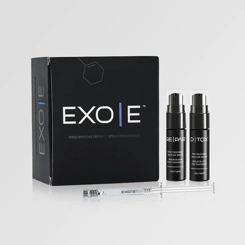 exo e kit - Filler Direct Wholesale
